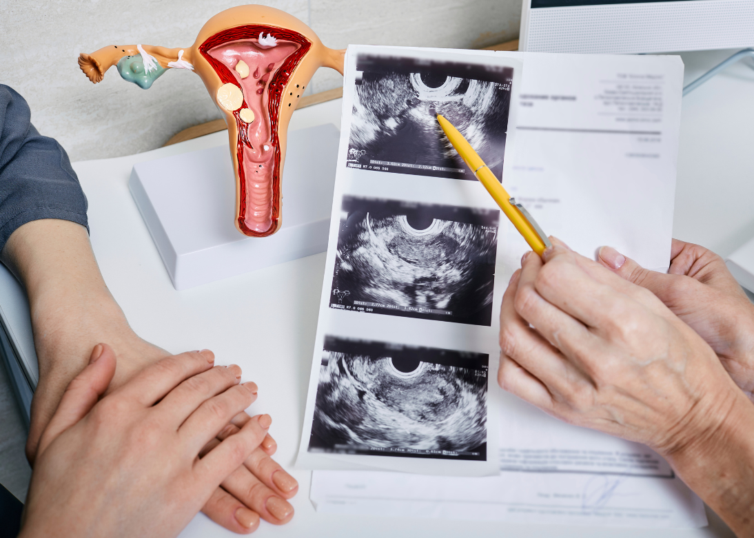 Gynecology Consultation